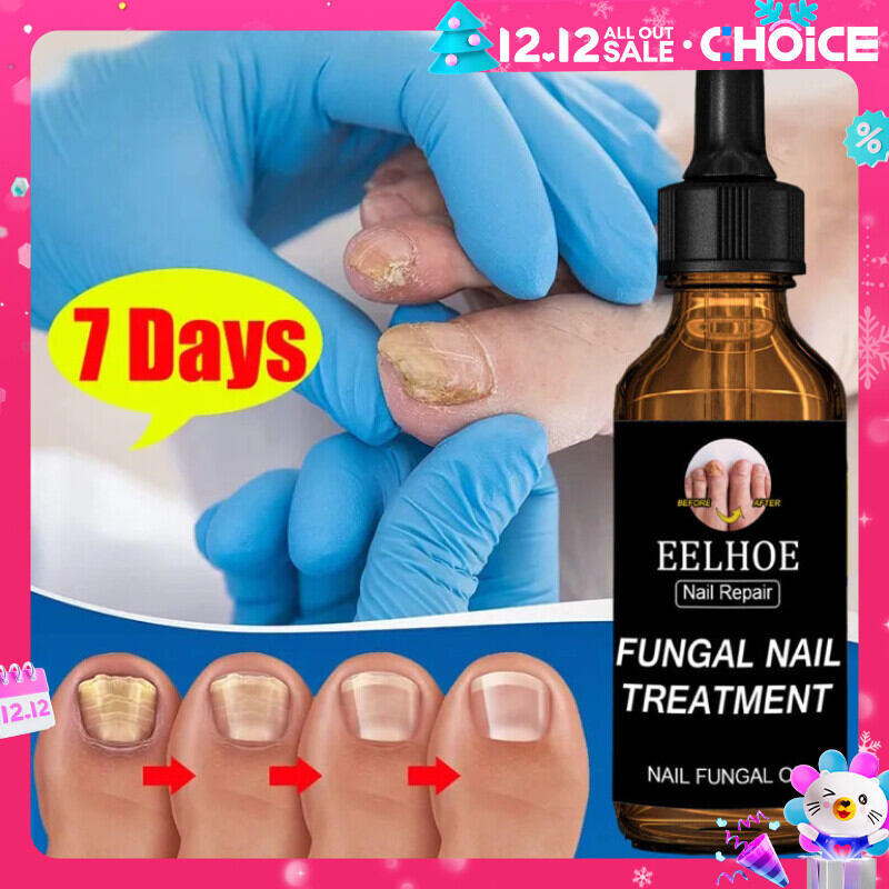 Serum dưỡng móng tay chân, loại bỏ nấm, tái tạo giúp dày móng, bóng khỏe hiệu quả 4 tuần 30ml