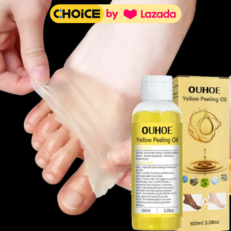 Nước Peling Oil Thay Da Sinh Học Khử Mùi Hôi Bỏ Lớp Da Thô Cứng Hỗ Trợ Làm Sáng Hiệu Quả Trong 2-7 Ngày