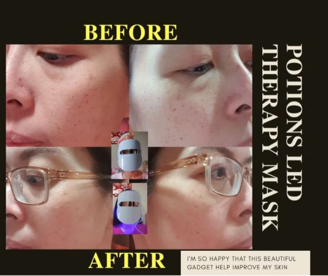 [SG INSTOCK] Allureskin Potions LED Photon Therapy Mask