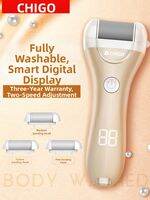 Chigo | Foot Dead Skin Remover & Callus File